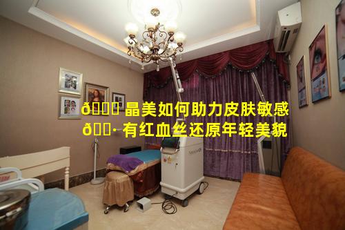 🐈 晶美如何助力皮肤敏感 🌷 有红血丝还原年轻美貌